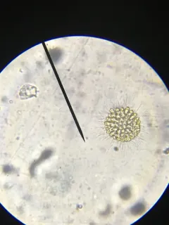 Chrysosphaerella longispina thumbnail 4