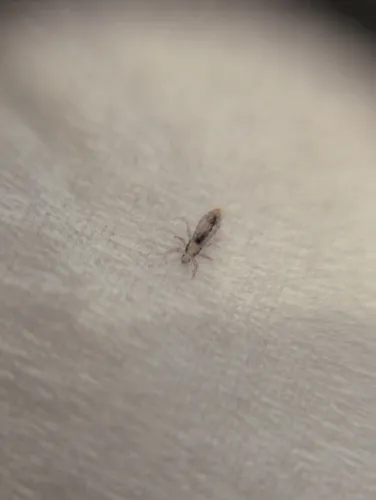 Human Louse