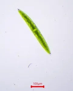 Closterium acerosum thumbnail 4