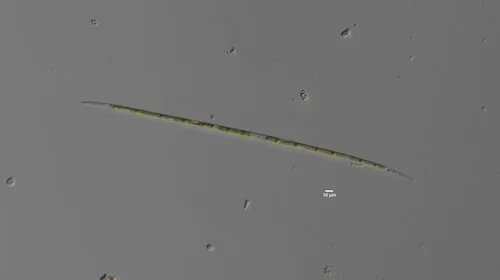 Closterium gracile