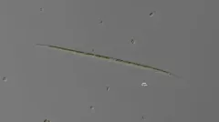 Closterium gracile thumbnail 1