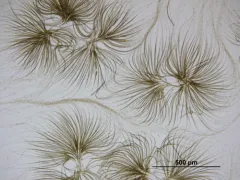 Gloeotrichia echinulata thumbnail 2