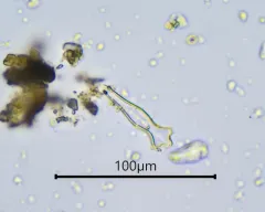 Gomphonema acuminatum thumbnail 3