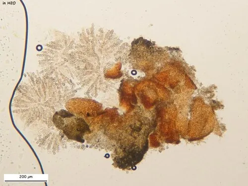 Pronectria echinulata