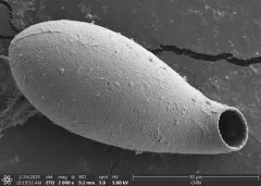 Cyphoderia ampulla thumbnail 1