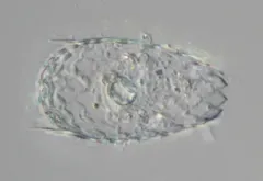 Euglypha acanthophora thumbnail 3