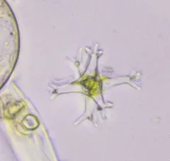 Staurastrum brachiatum thumbnail 3