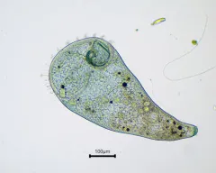 Stentor coeruleus thumbnail 4