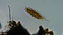 Mallomonas insignis thumbnail 2
