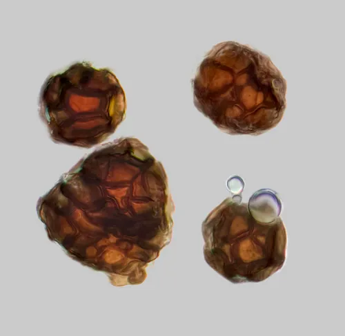 Urocystis erythronii
