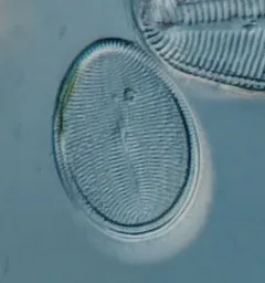 Cocconeis placentula thumbnail 1