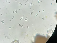 Granite Firedot Lichen thumbnail 3