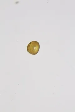 Arcella hemisphaerica thumbnail 2