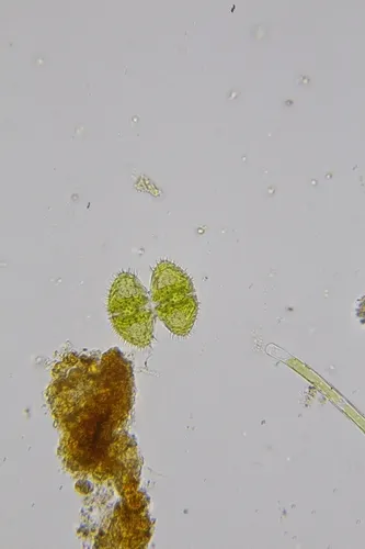 Staurastrum teliferum