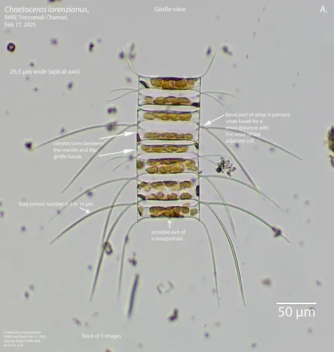 Chaetoceros lorenzianus