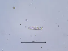 Euglypha cristata thumbnail 3