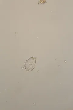 Euglypha strigosa thumbnail 3