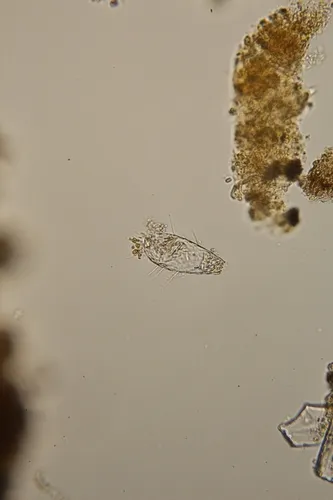Euglypha filifera