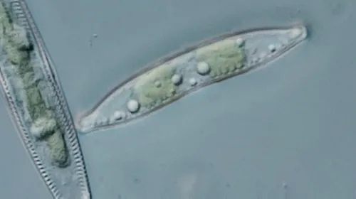 Hantzschia amphioxys