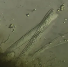 Claussenomyces olivaceus thumbnail 3