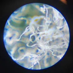 Erysiphe sedi thumbnail 4