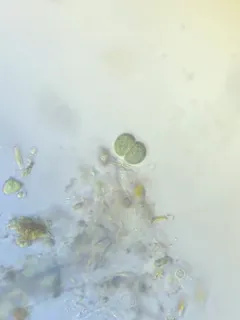 Chroococcus turgidus thumbnail 3