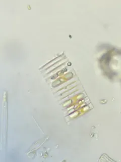Fragilaria capucina thumbnail 2