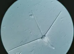 Clavariopsis aquatica thumbnail 1