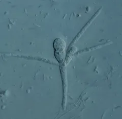 Tetracladium marchalianum thumbnail 2
