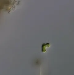 Micractinium pusillum thumbnail 1