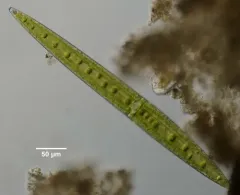 Closterium acerosum thumbnail 1