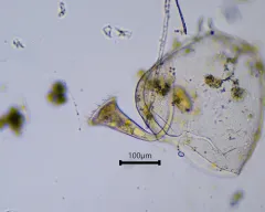 Stentor igneus thumbnail 3