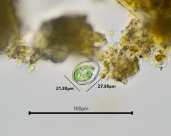 Paulinella chromatophora thumbnail 4
