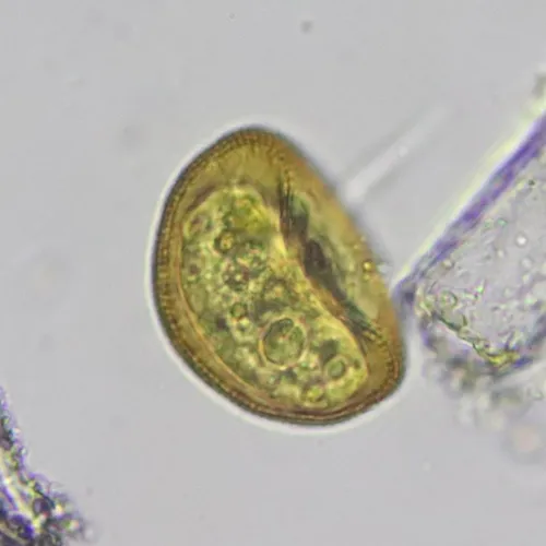 Arcella hemisphaerica