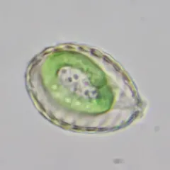 Paulinella chromatophora thumbnail 1