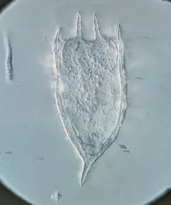 Keratella cochlearis thumbnail 3