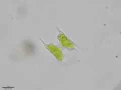 Staurodesmus extensus thumbnail 1