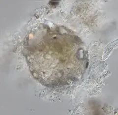 Difflugia globulosa thumbnail 2