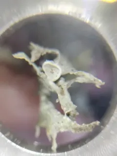 cartilage lichen thumbnail 1