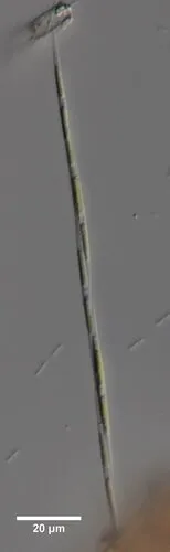 Monoraphidium griffithii