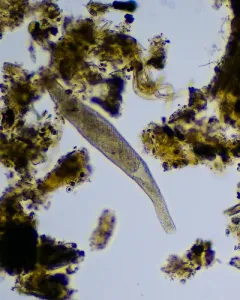 Spirostomum teres thumbnail 2