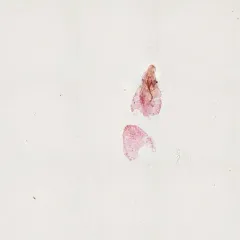 Japanese maple scale thumbnail 3