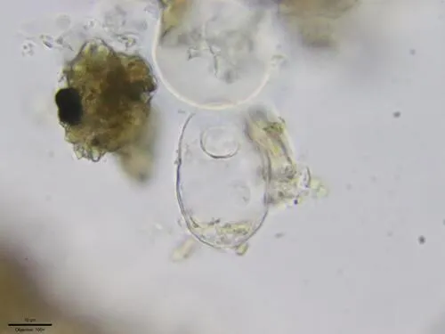 Trinema complanatum