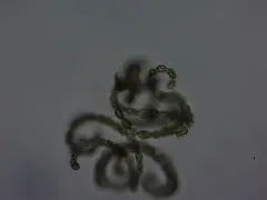 Dolichospermum lemmermannii thumbnail 3