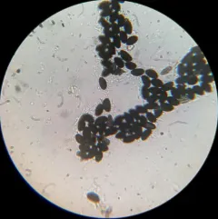 Xylaria ellisii thumbnail 4
