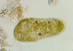 Stentor polymorphus thumbnail 1