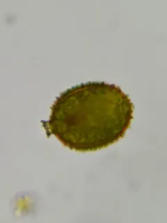 Trachelomonas hispida thumbnail 3