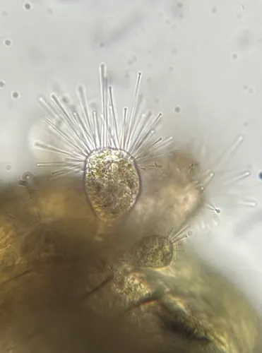Tokophrya cyclopum