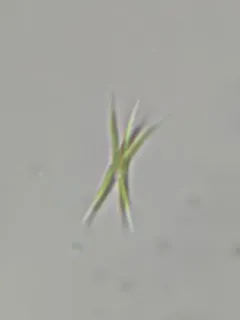Ankistrodesmus falcatus thumbnail 2