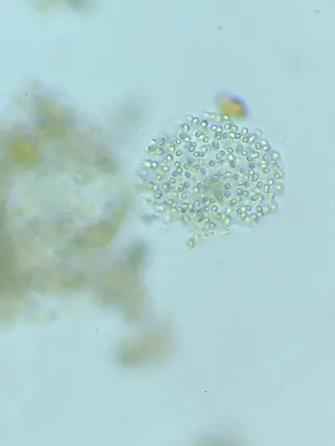 Aphanocapsa planctonica